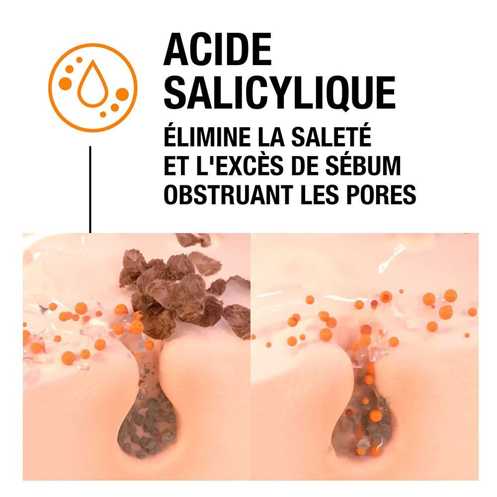 Neutrogena Gel Anti-Boutons Sos Action Immédiate À L'Acide Salicylique Peaux Acnéiques 15Ml